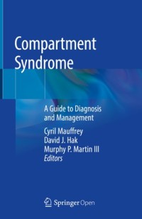 Image of Compartment syndrome :a guide to diagnosis and management